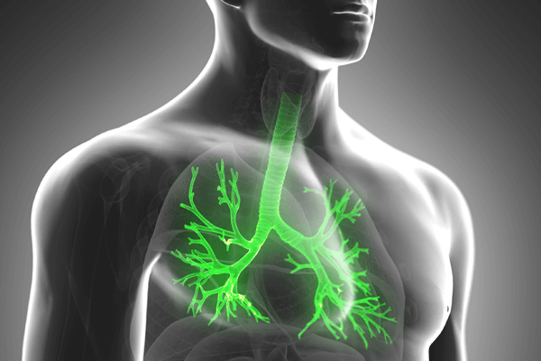 Pneumonia associada à ventilação mecânica – PAV