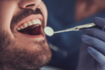 O preparo inicial na Periodontia e Implantodontia